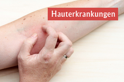 Hauterkrankung